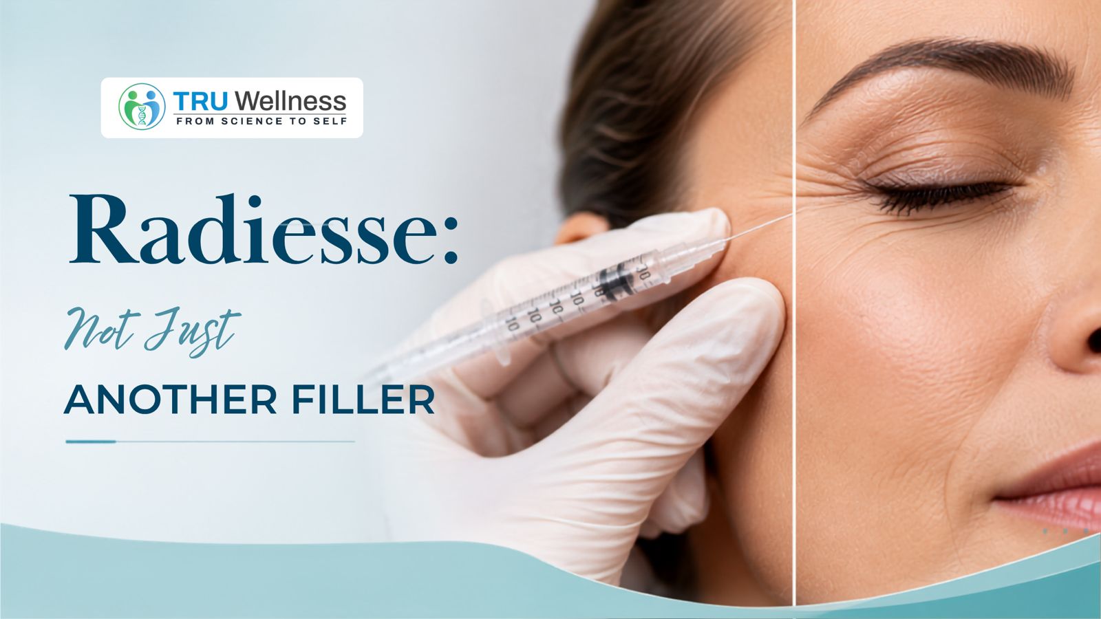 Radiesse: Not Just Another Filler